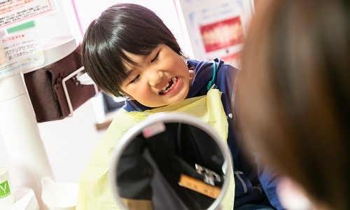 ネオキャップ・ビムラー矯正